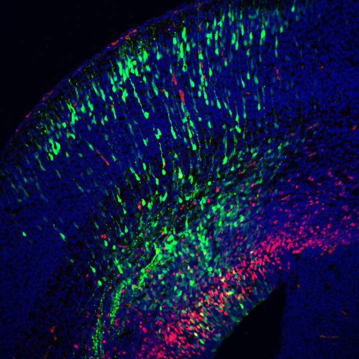 Neuronal precursor's radial migration in the brain (Javier Díaz Alonso). iHealth
