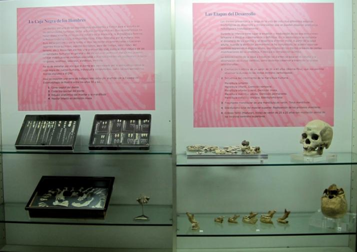 Museo de Antropología Médica y Forense, Paleopatología y Criminalística «Profesor Reverte Coma» Fotografía 2