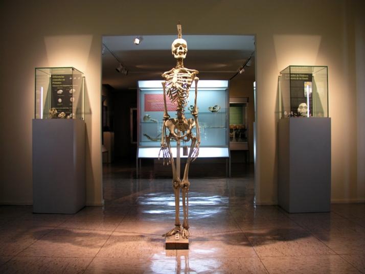 Museo de Antropología Médica y Forense, Paleopatología y Criminalística «Profesor Reverte Coma» Fotografía 5
