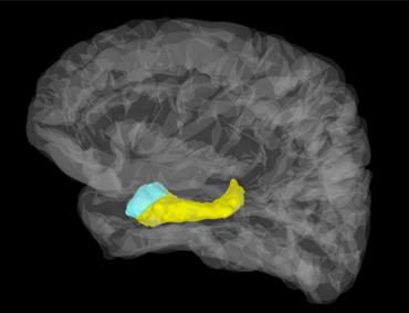  Brain imaging in which the amygdala appears in blue and the hippocampus in yellow. / Stephan Moratti.
