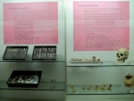 Museo de Antropología Médica y Forense, Paleopatología y Criminalística «Profesor Reverte Coma» Fotografía 2