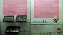 Museum of Medical and Forensic Anthropology, Paleopathology and Forensic «Profesor Reverte Coma» Photo 2